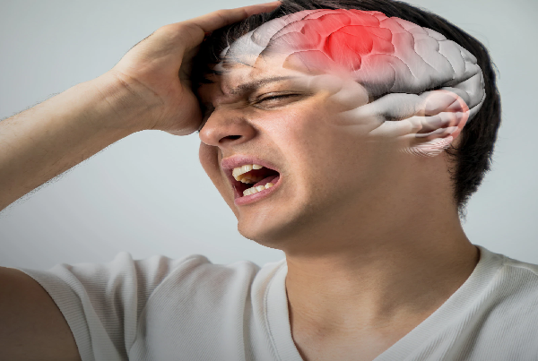 Brain Stroke