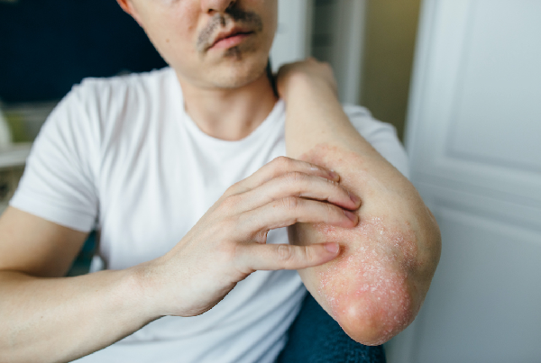 Skin Disease